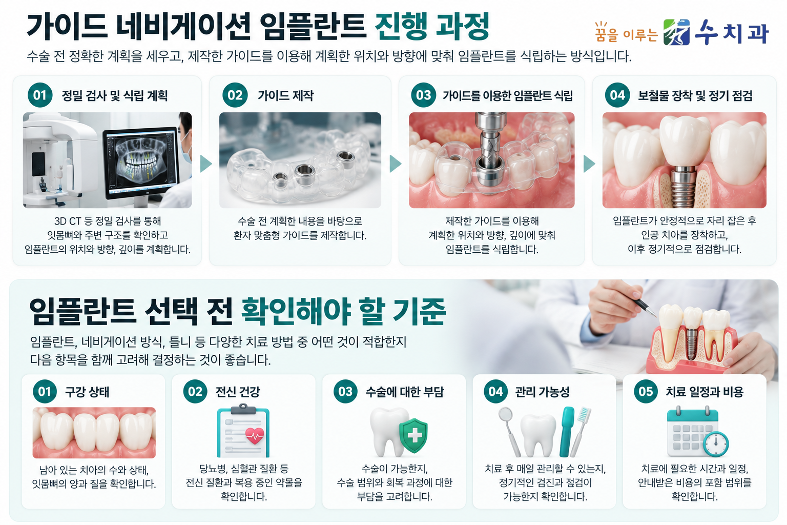 가이드 네비게이션 임플란트의 수술 전 계획과 가이드 제작, 식립 과정 및 치료 선택 기준