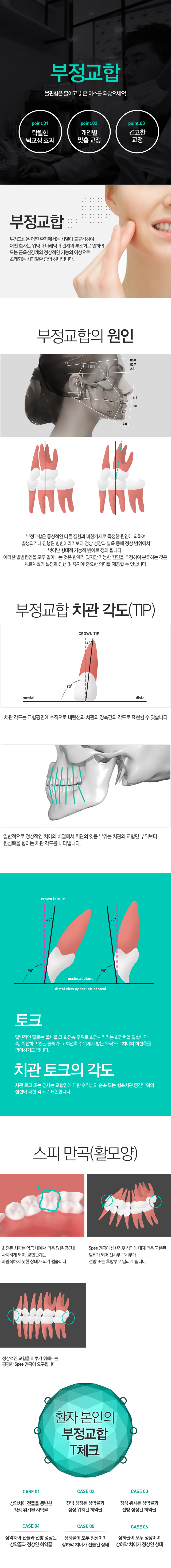 부정교합